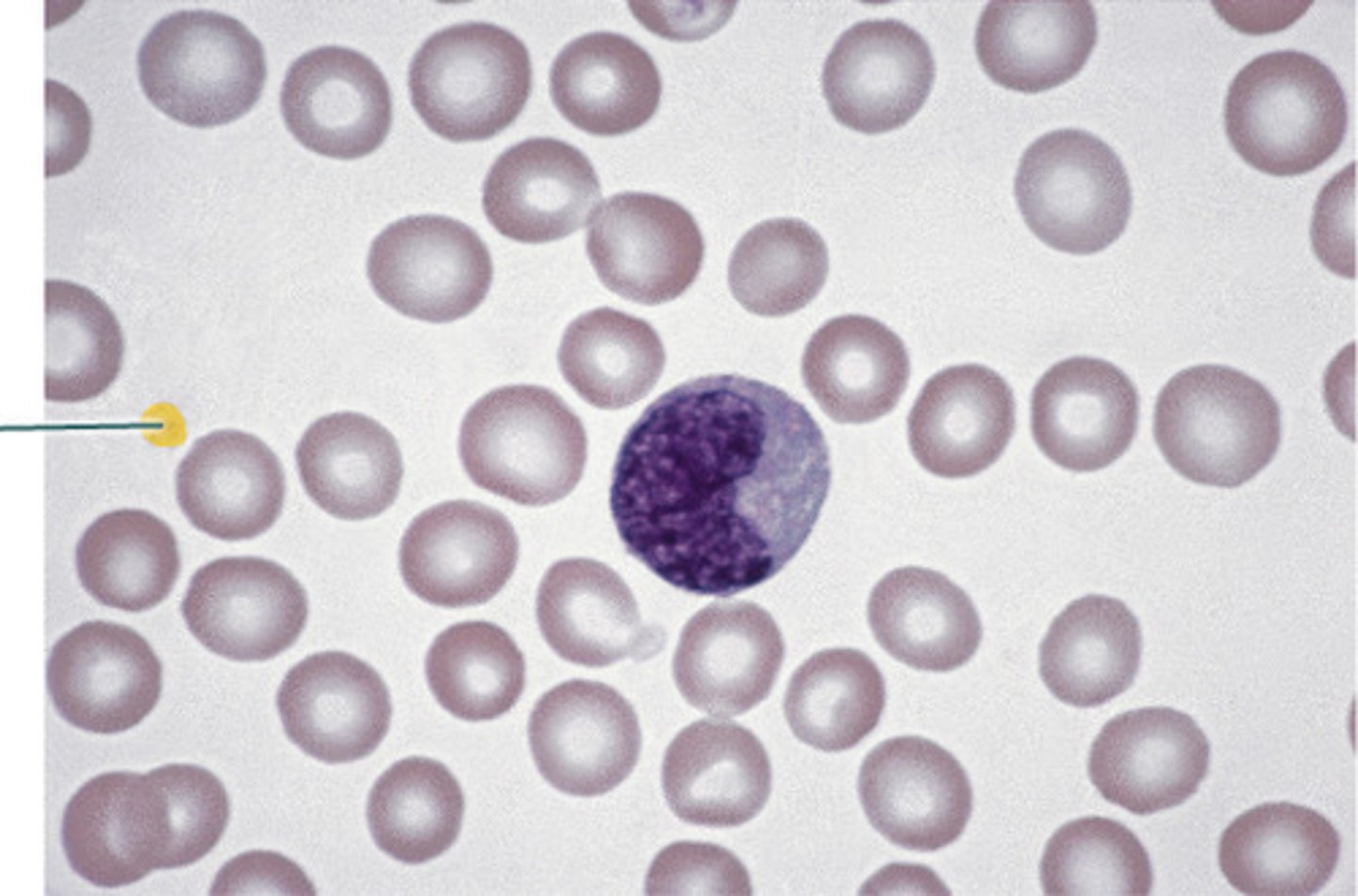 <p>Biconcave disc</p>