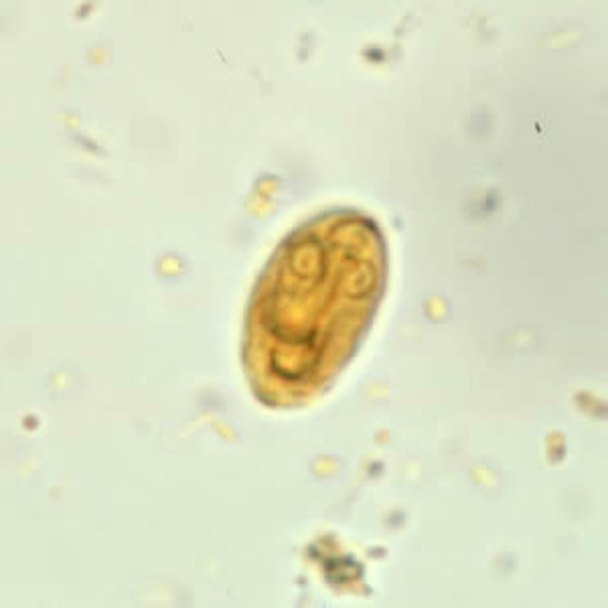<p>Dormant resting stage of protozoa.</p>