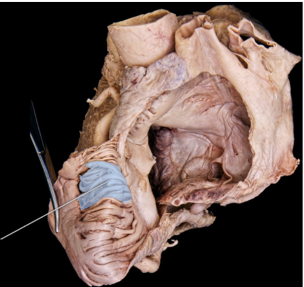 <p>pectinate muscles</p>