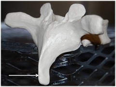 Name this specific part of the thoracic vertebra.