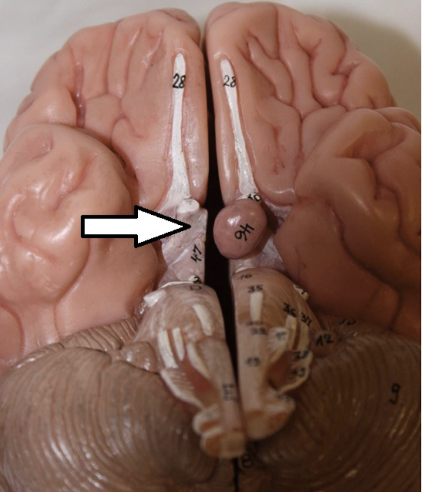<p>identify the structure</p>