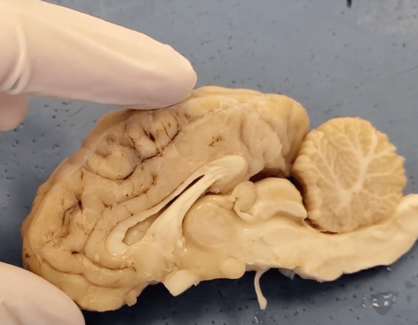 <p>Area of the brain responsible for all voluntary activities of the body</p>