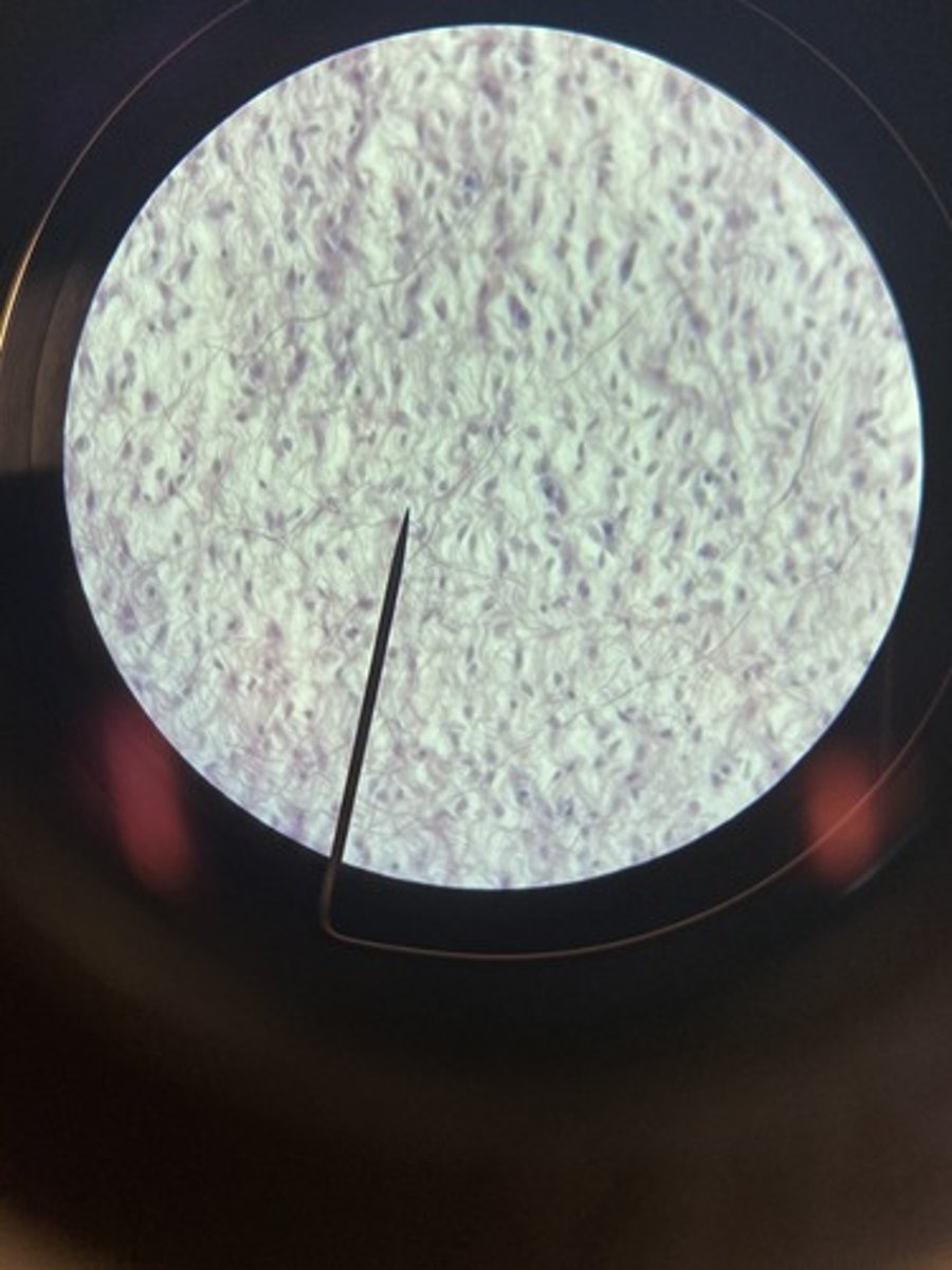 <p>Fibrocytes - with elastic fibers (black) and pink fibers (collagen)</p>