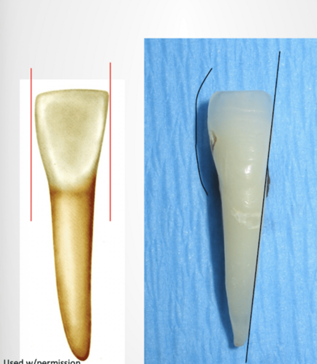 <p>- M profile of crown is nearly straight</p><p>- D crown profile is more convex (sticks out)</p><p>- D HOC more cervical than M HOC</p><p>- Root is wider facioingually than mesiodistally</p>