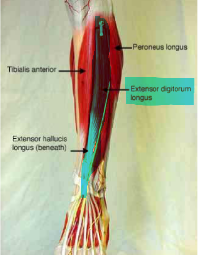<p>Extensor Digitorum Longus</p>