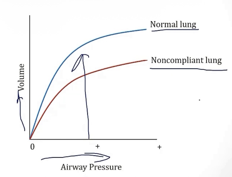 <p>-small</p><p>-small; large</p><p>-lower</p><p>-lesser; pneumonia, pulmonary edema pulmonary fibrosis</p><p>-greater; emphysema, aging, surfactant</p>
