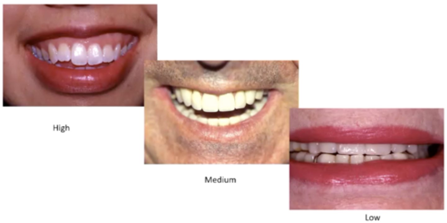 <p>What are these showing differences of?</p>