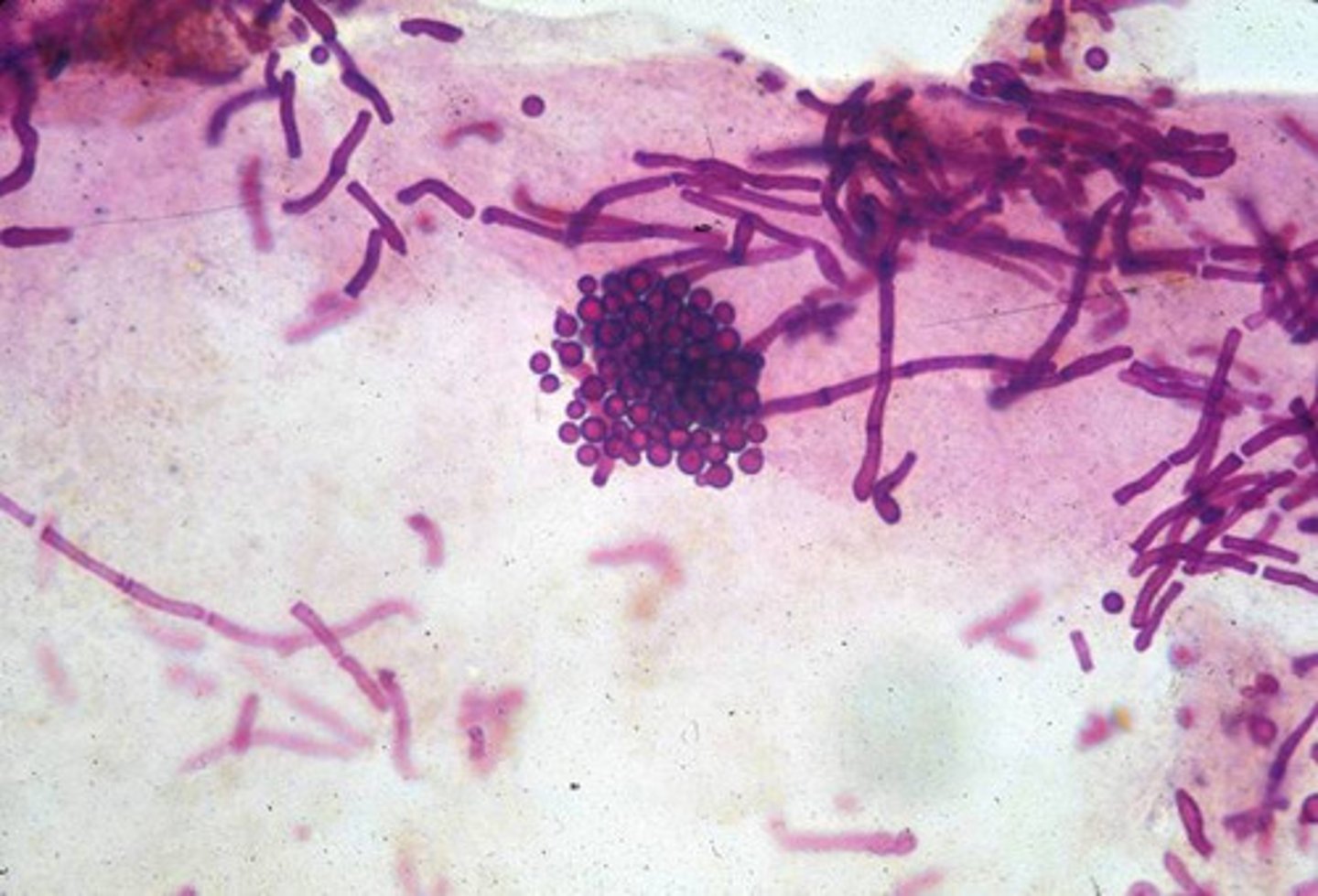<p>Malassezia furfur</p>