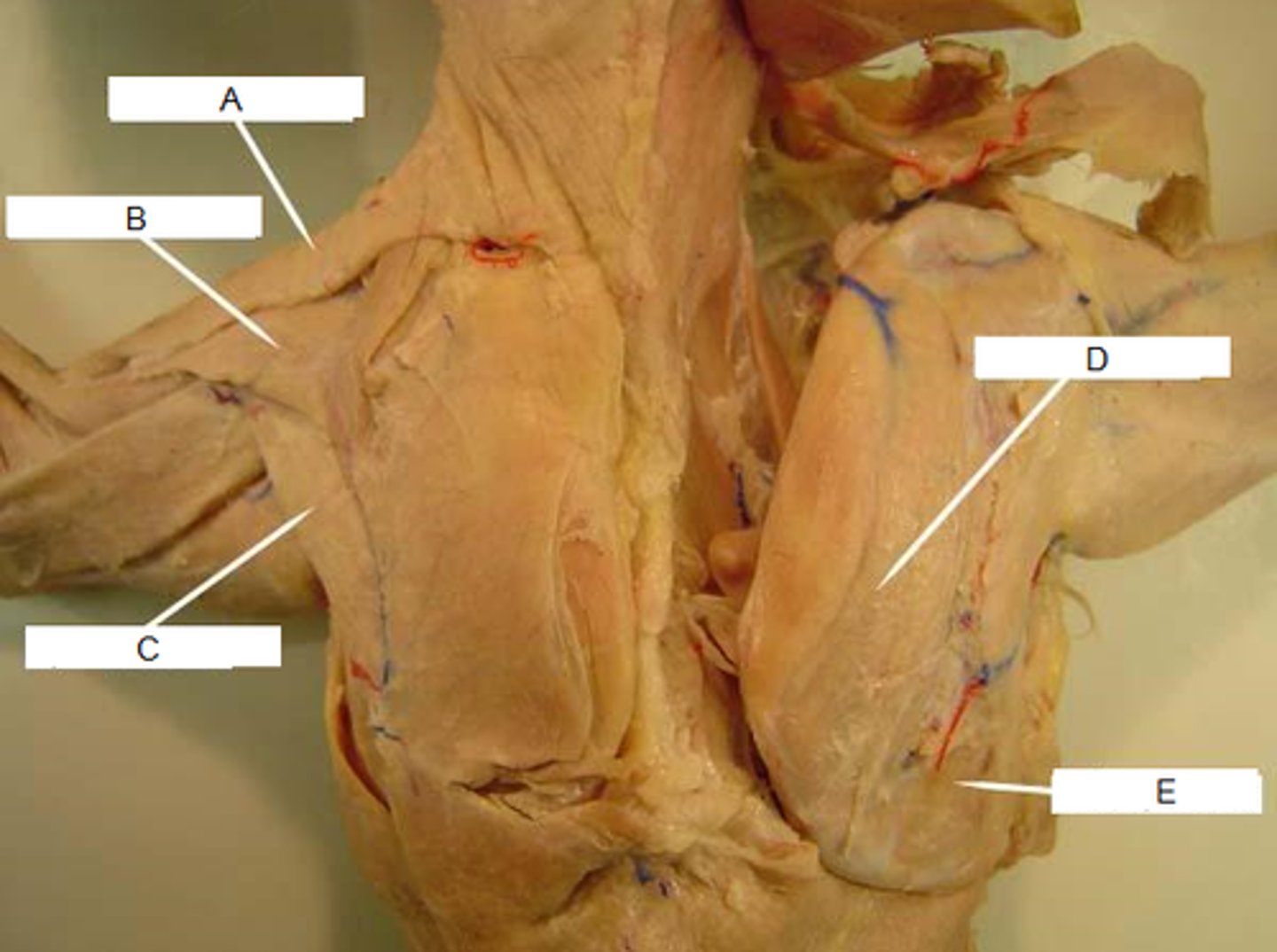 <p>name this muscle (E)</p>