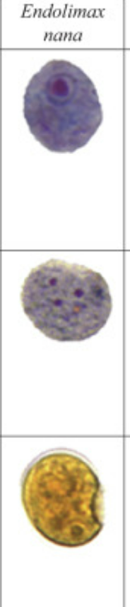 <p>Endolimax nana </p>