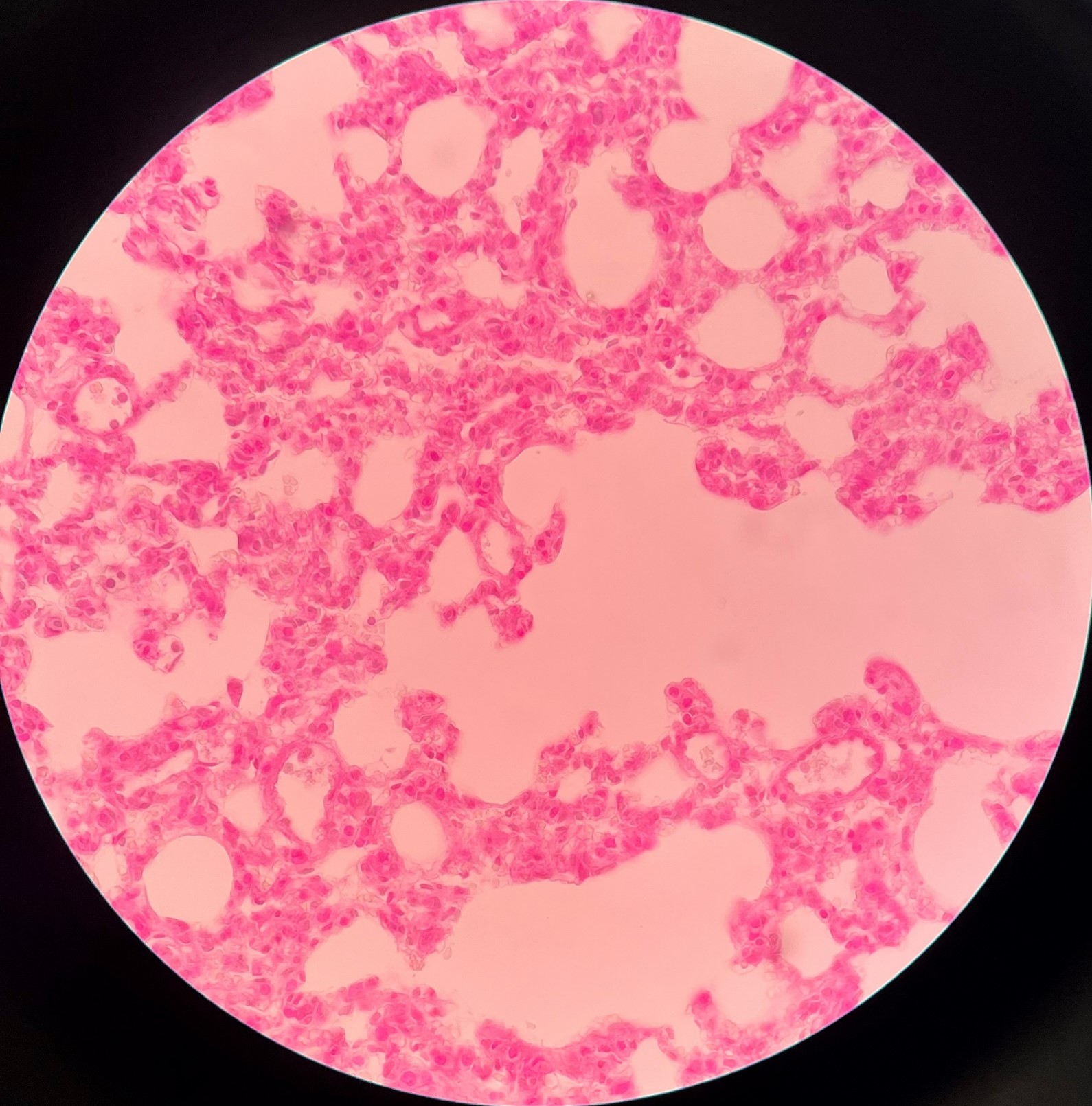 • Smaller branches of a respiratory bronchiole.

• Leads into alveolar sacs.

• Not shown in image.