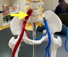 <p>Name the blood vessel.</p>