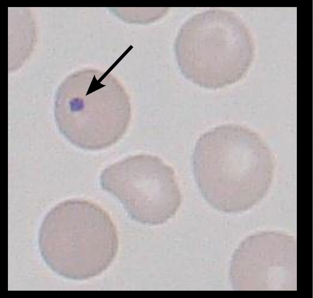 <p>What RBC is this? </p>