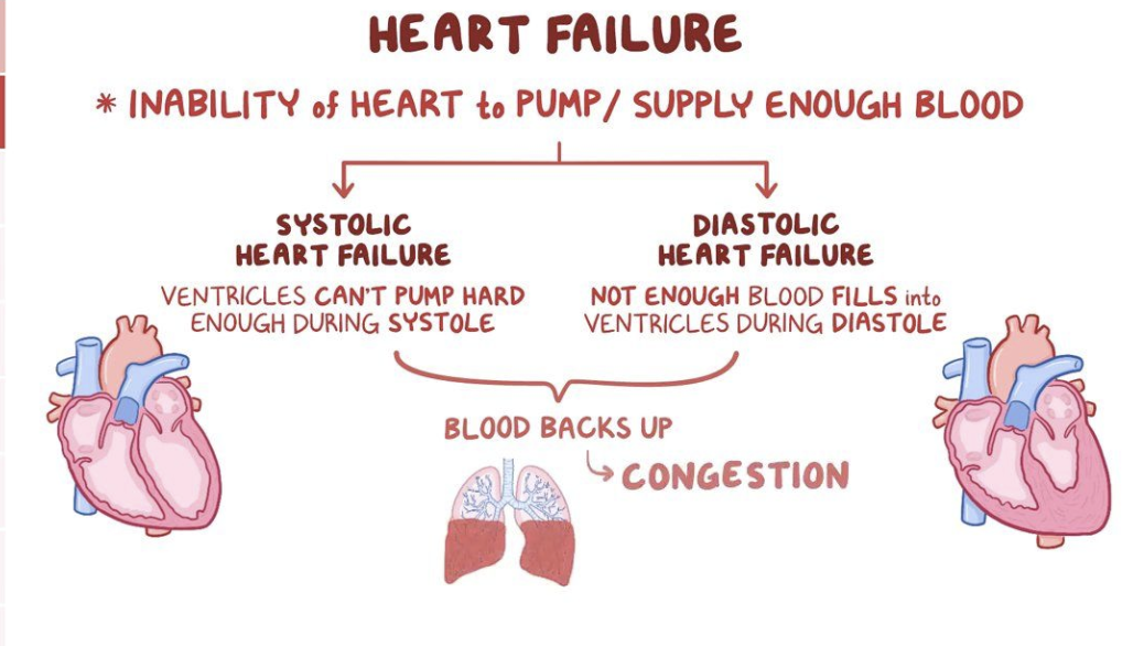<p>What is heart failure?</p><p>Heart failure sys vs dis</p><p>what is Ejection fraction</p>