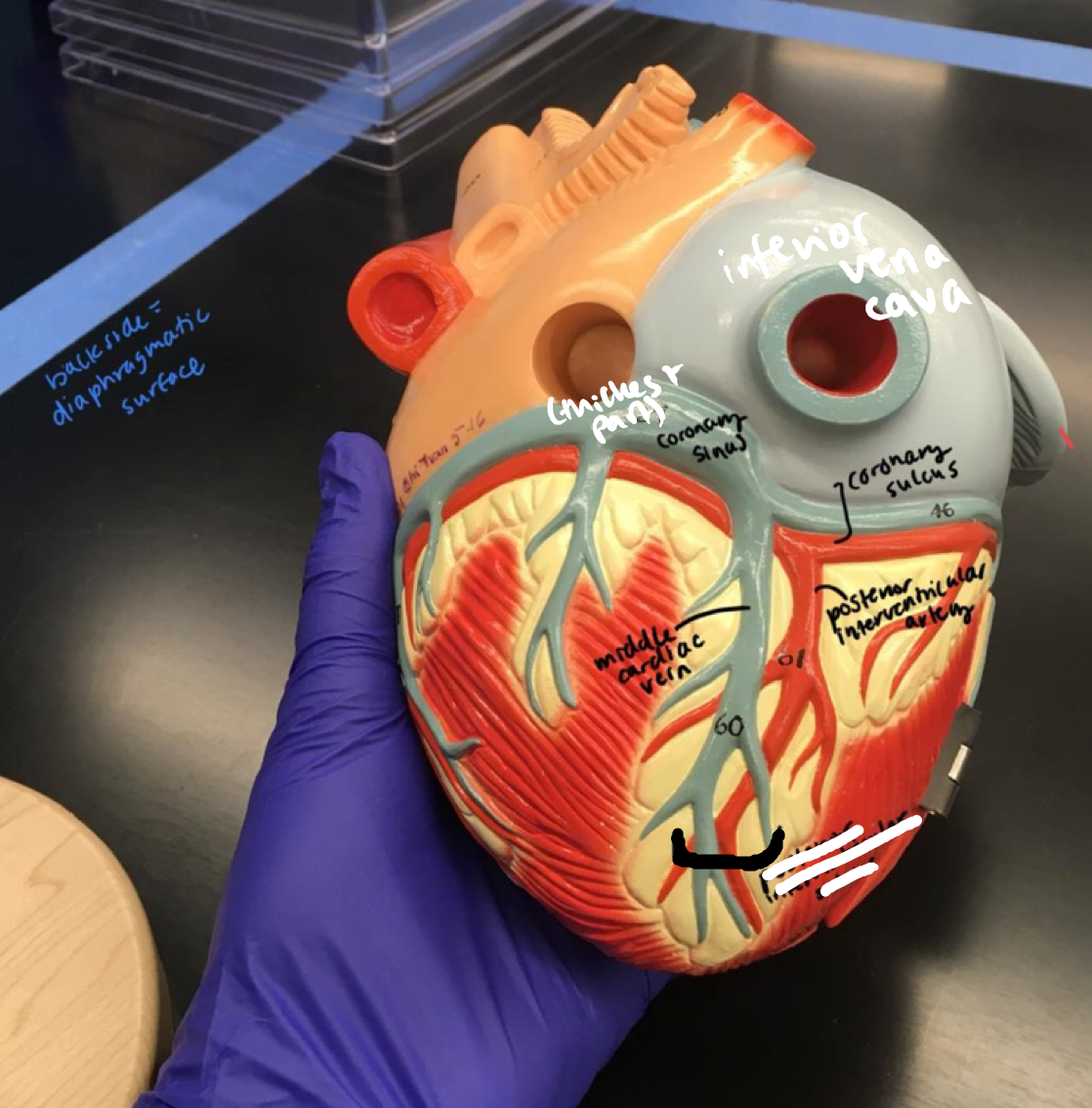 <p>On the back of the heart, the section encapsulating the 2 wires</p>