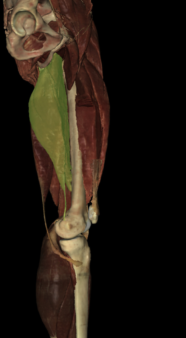 <p>Identify the Structure</p>