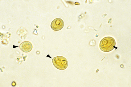 <p>Chilomastix mesnili </p><p>Troph= 10-15 um</p><p>Cyst= 6-11 um</p>
