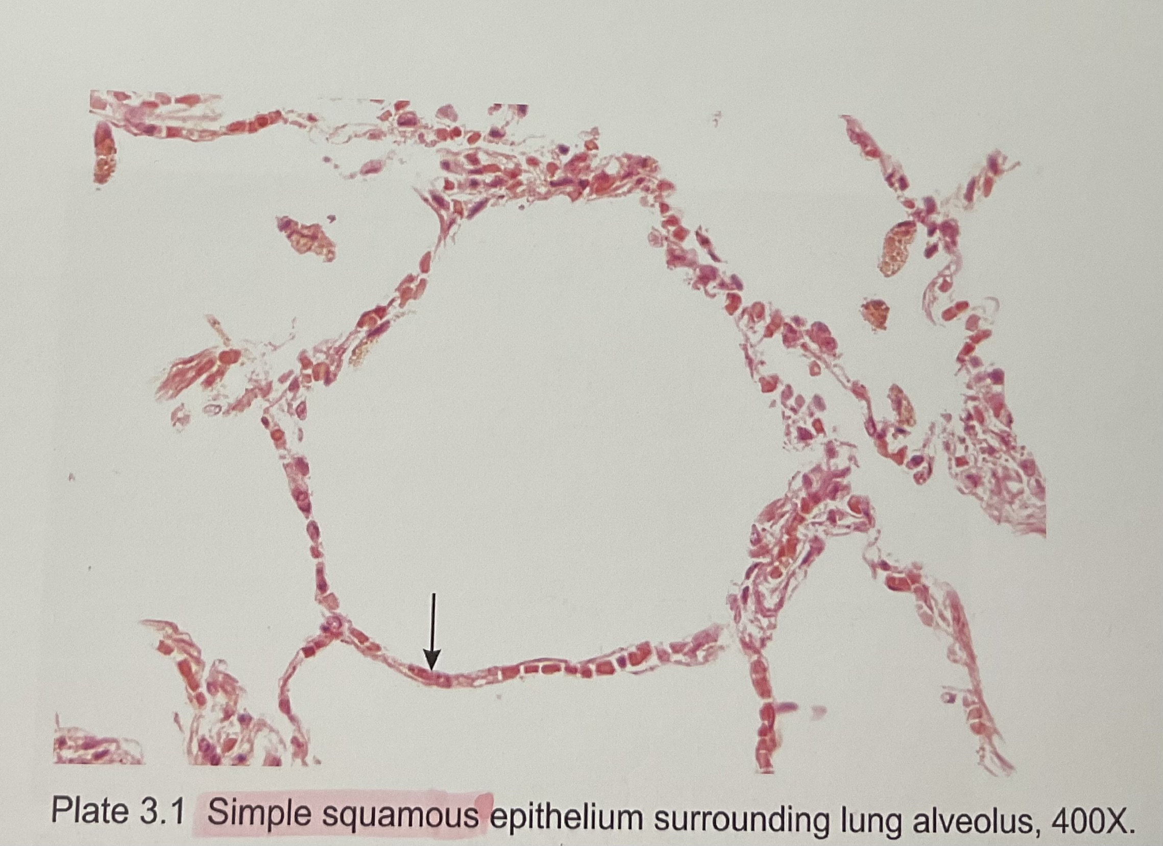 <p>Simple squamous 2</p>