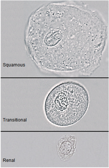 <p>large, small nuclei size of RBC</p>