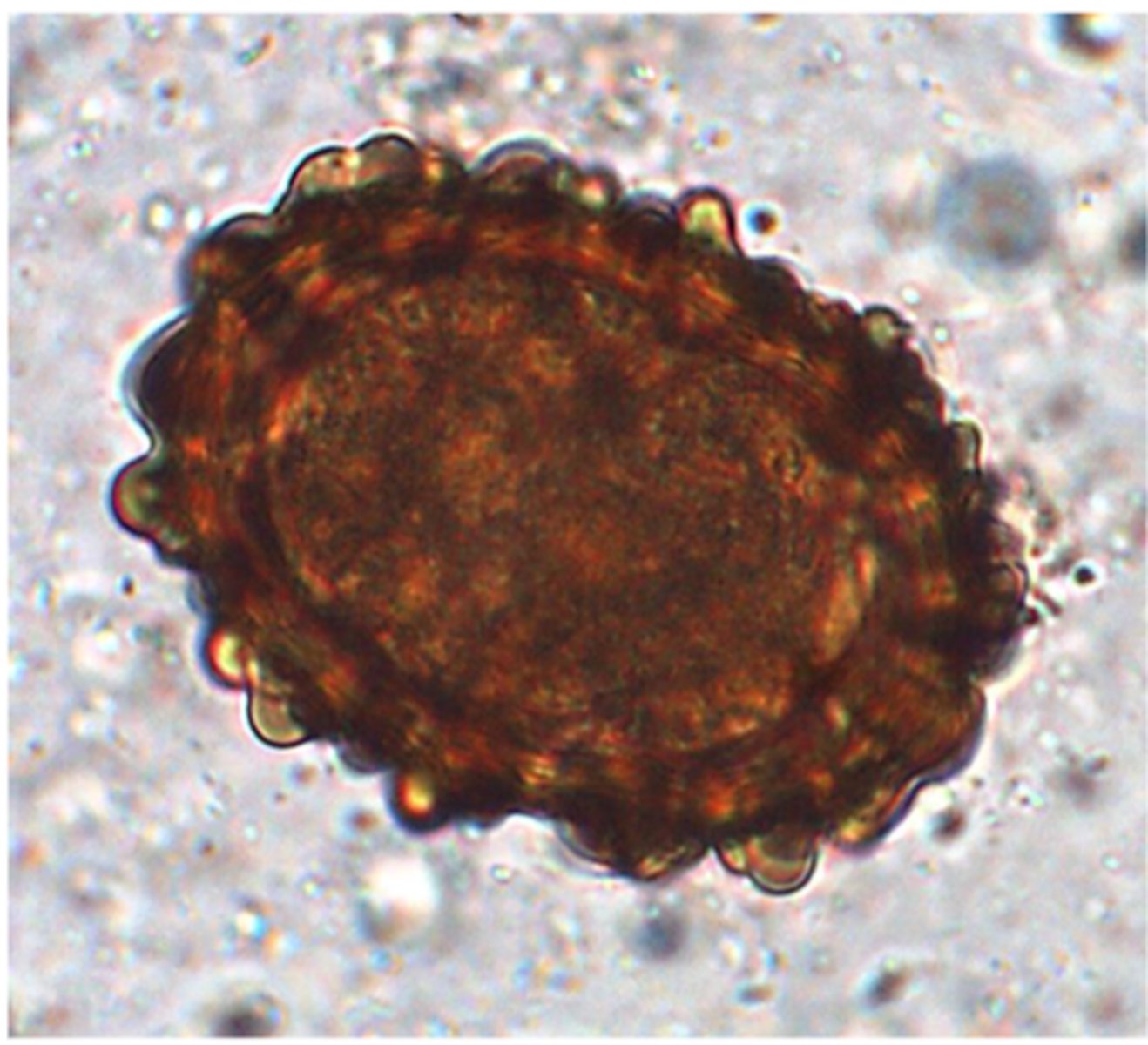 <p>Station 13:</p><p>The nematode egg on the microscope plate was found in a faecal float of a sample collected from a group of poorly growing finisher pigs. Some of the pigs from the same group manifest dyspnoea and coughing</p>