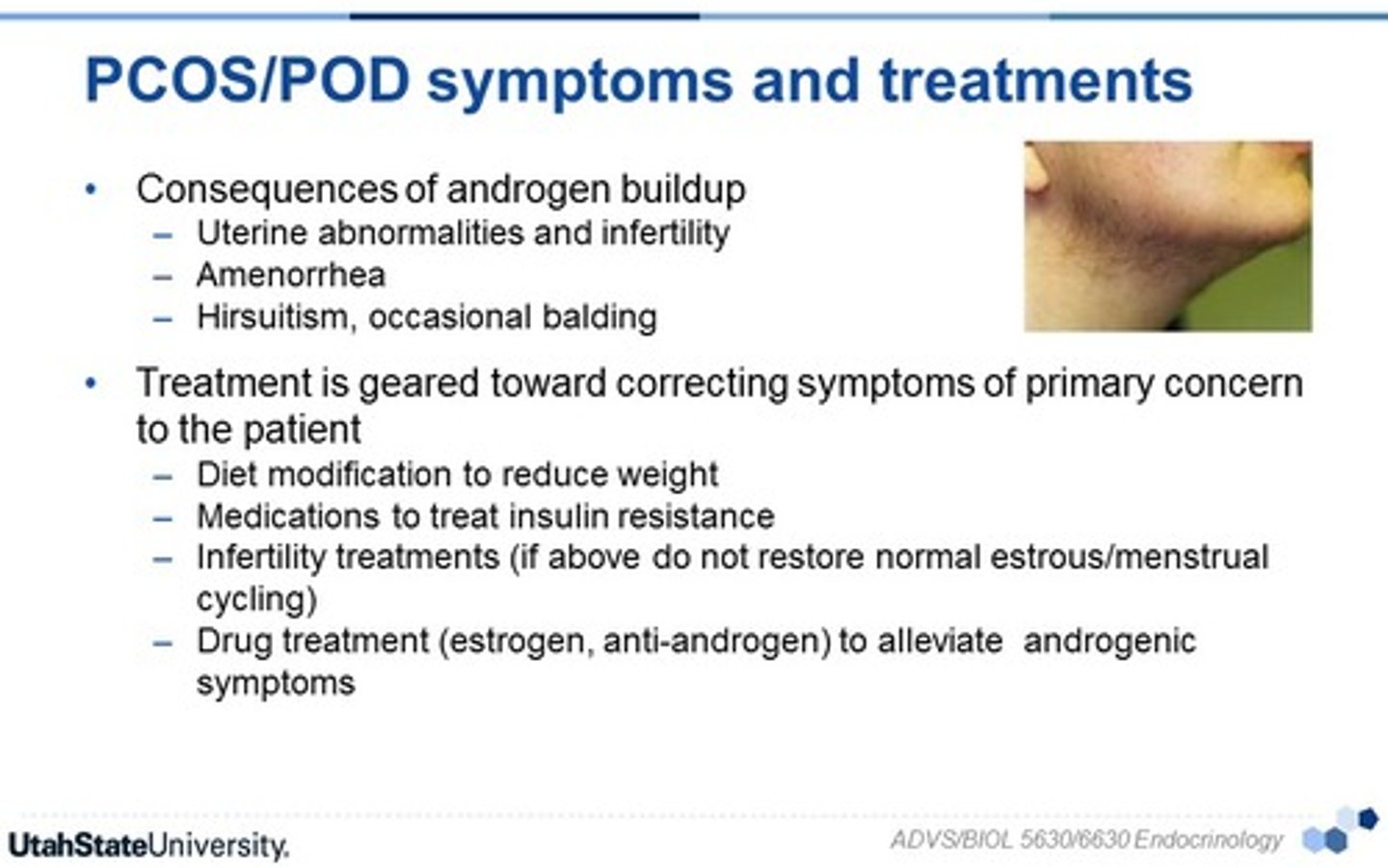 <p>• Weight loss</p><p>• OCPs</p><p>• Spironolactone (hirsutism)</p><p>• Metformin (insulin resistance)</p><p>• Clomiphene (infertility)</p>