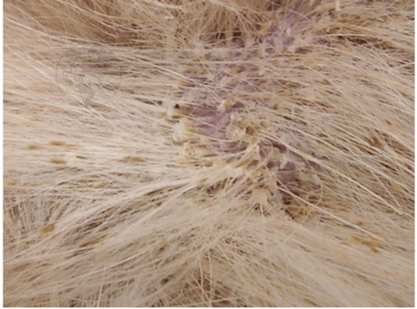 <p>what is this condition called? what yeast species causes it? what sample would we take?</p>