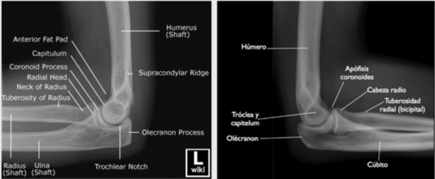 <p>In lateral projection, the central axis of the radius aligns with the center of the region, with the radius being somewhat anterior to the ulna. </p>