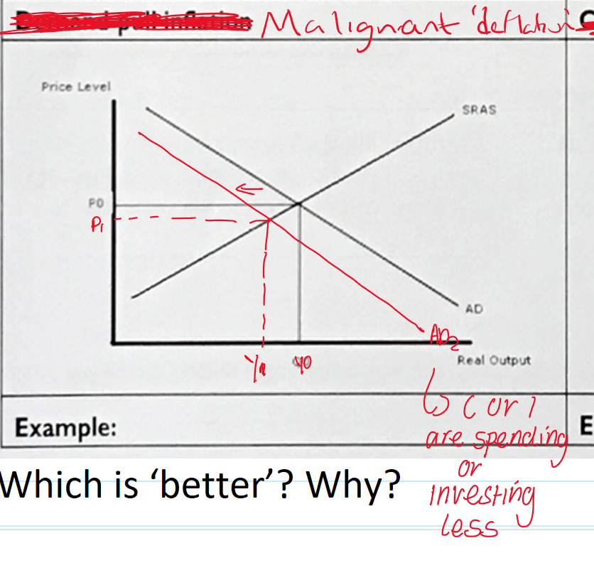 <p>what is malignant deflation ?</p>