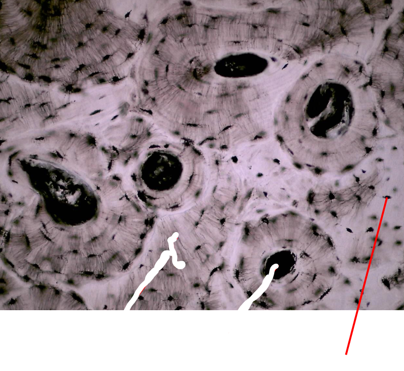 <p>What part of human bone tissue is this?</p>