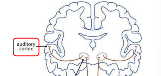 <p>first cortical area for processing audition (located in temporal lobe) </p>