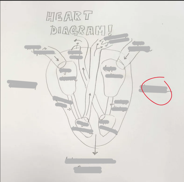 <p>What Side is this?</p>