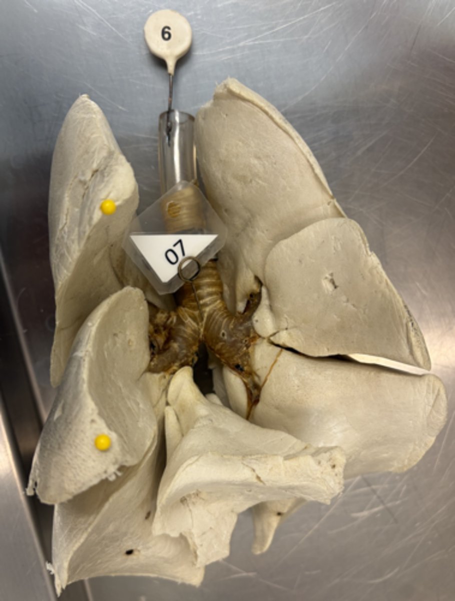 <p>a. Identify the pinned structure.</p><p>b. ID the lymph node found lateral to the pin.</p>