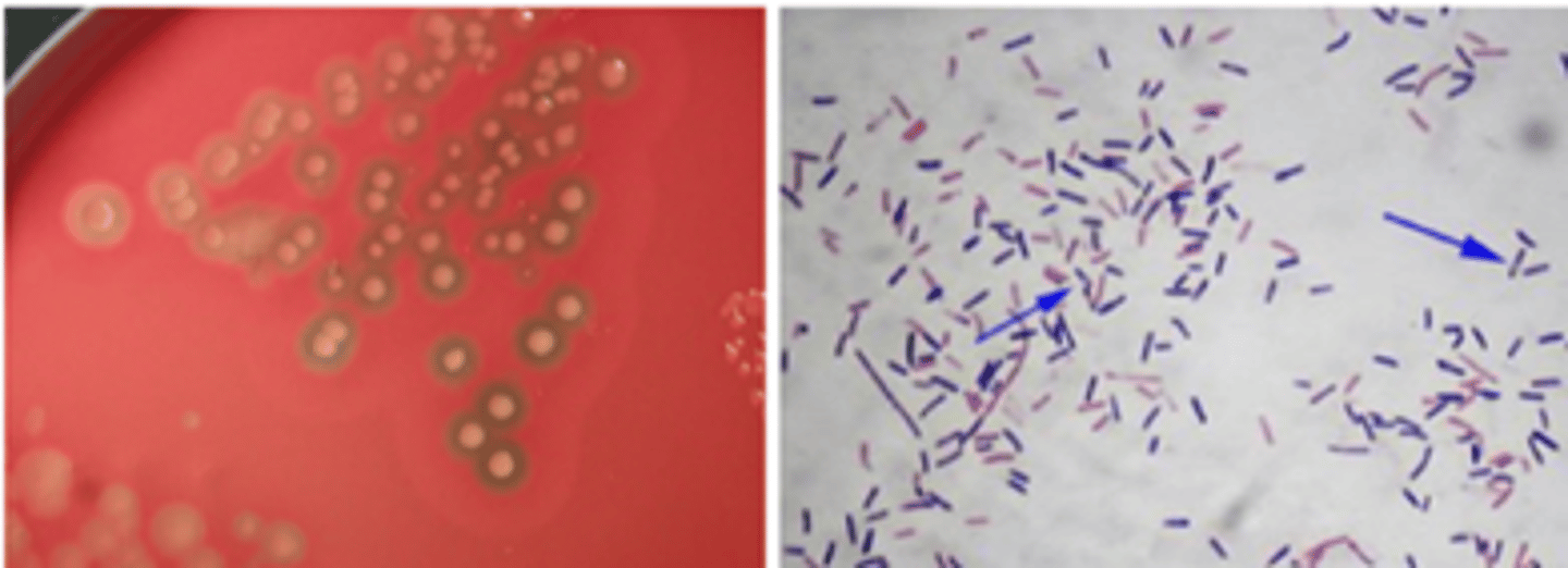 <p>· Reservoir: marine and terrestrial environment; GIT</p><p>· Infections: gas gangrene; gastroenteritis</p>