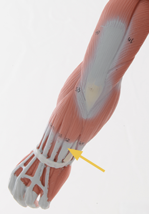 <p>extensor carpi ulnaris m.</p><p>O: Lateral epicondyle of humerus<br>I: Base of 5th metacarpal<br>A: wrist extension and ulnar deviation<br>Inn: radial n. <br>-One of the most powerful extensor muscles at the wrist</p>