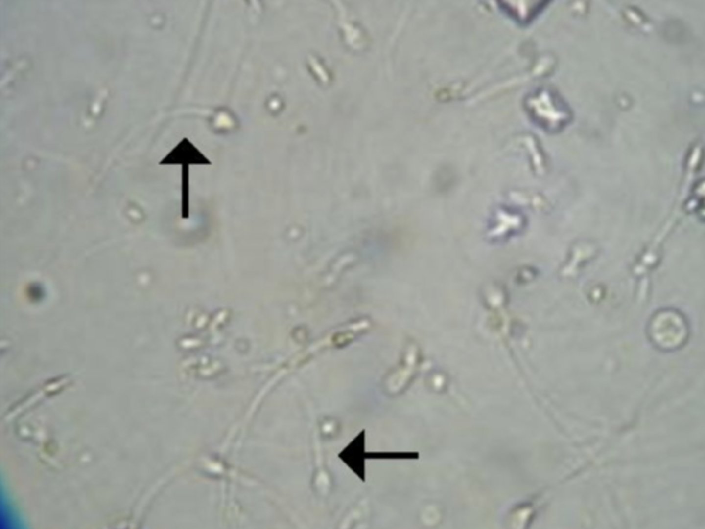 <p>have a characteristic oval body with a long, thin tail and are 50 microns long</p>