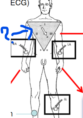 <p>What is that called</p>