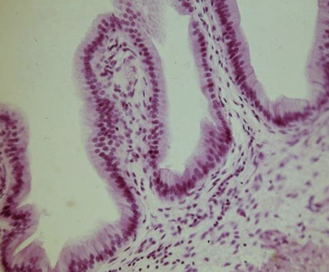 <p>absorbs nutrients, secretes mucus and enzymes, and moves substances when cilia are present.</p>
