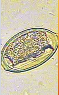 <p><span style="color: rgb(250, 243, 243);"><span>Pearsonema plica/ Pearsonema feliscati</span></span></p>