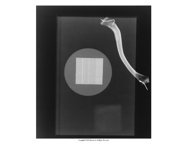 <p>What does this image tell you about contrast</p>