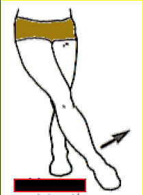 <p>What Movement is occurring?</p>