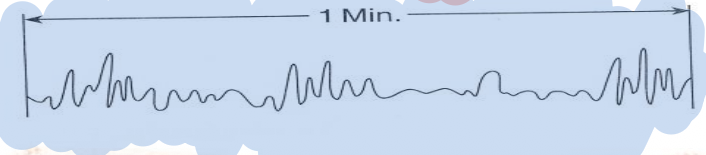 <p>What type of breathing is this?</p><p></p>