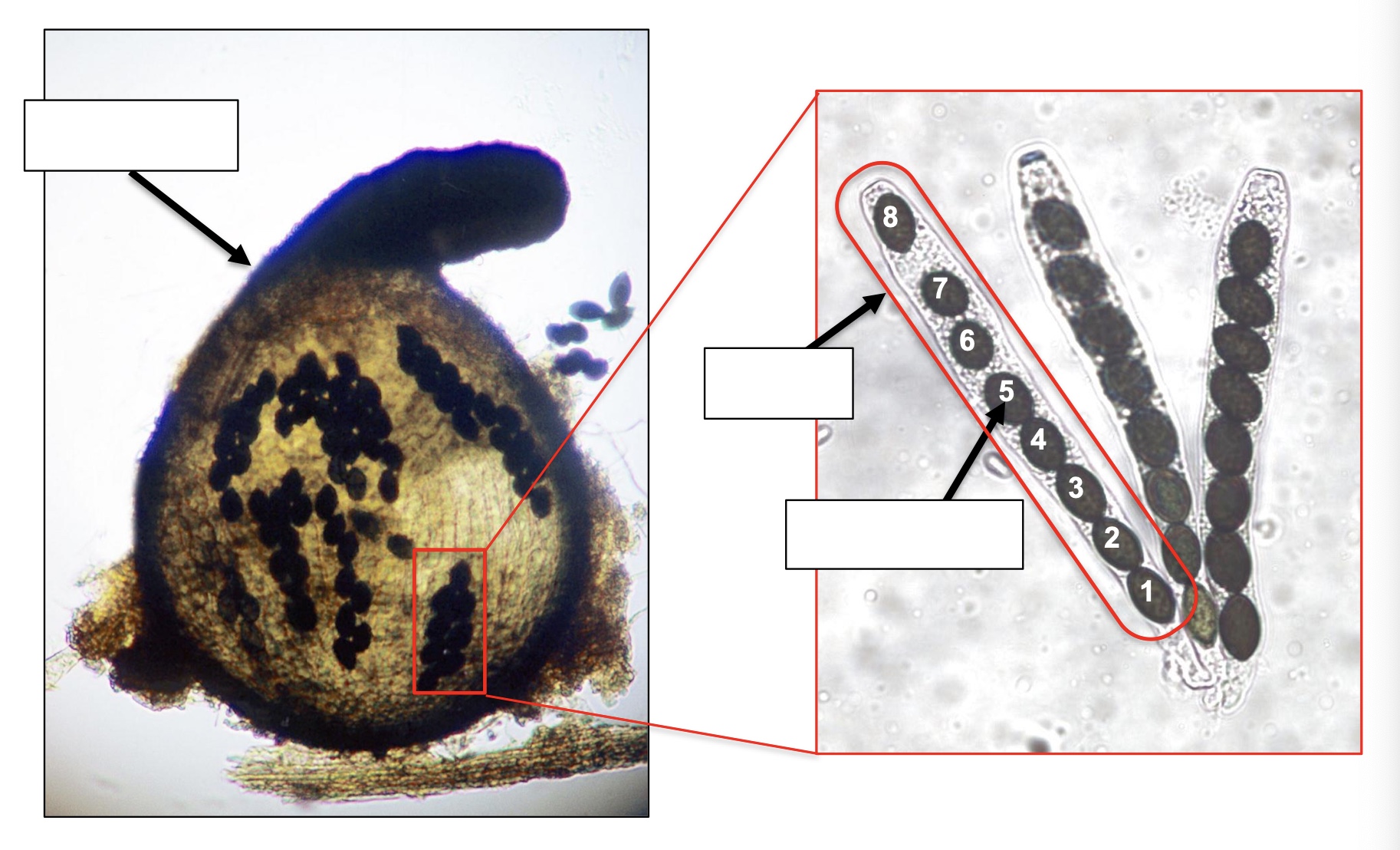 <p>Label ascocarp, ascus, and ascospore</p>