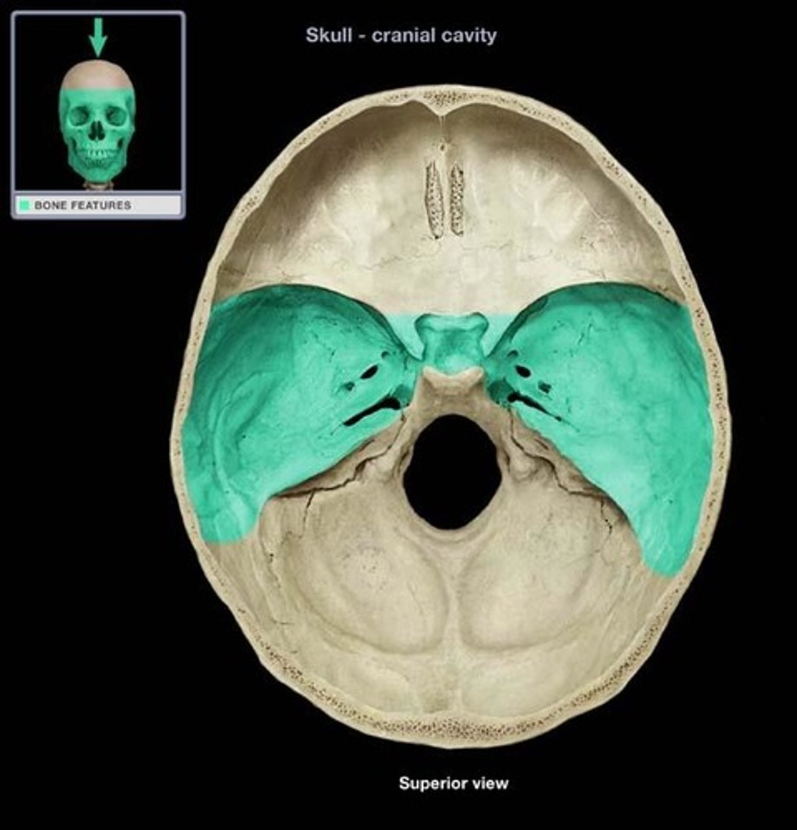 <p>the concave surface of the head overlying the temporal bone </p>