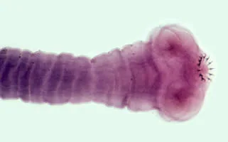 <p><span>Important diagnostic information may be provided by the accurate identification of a tapeworm proglottid found in a stool specimen. The gravid proglottid shown below is typical of which of the following species?</span></p><p>Diphyllobothrium latum</p><p>Hymenolepis diminuta</p><p>Hymenolepis nana</p><p>Taenia saginata</p><p>Taenia solium</p>