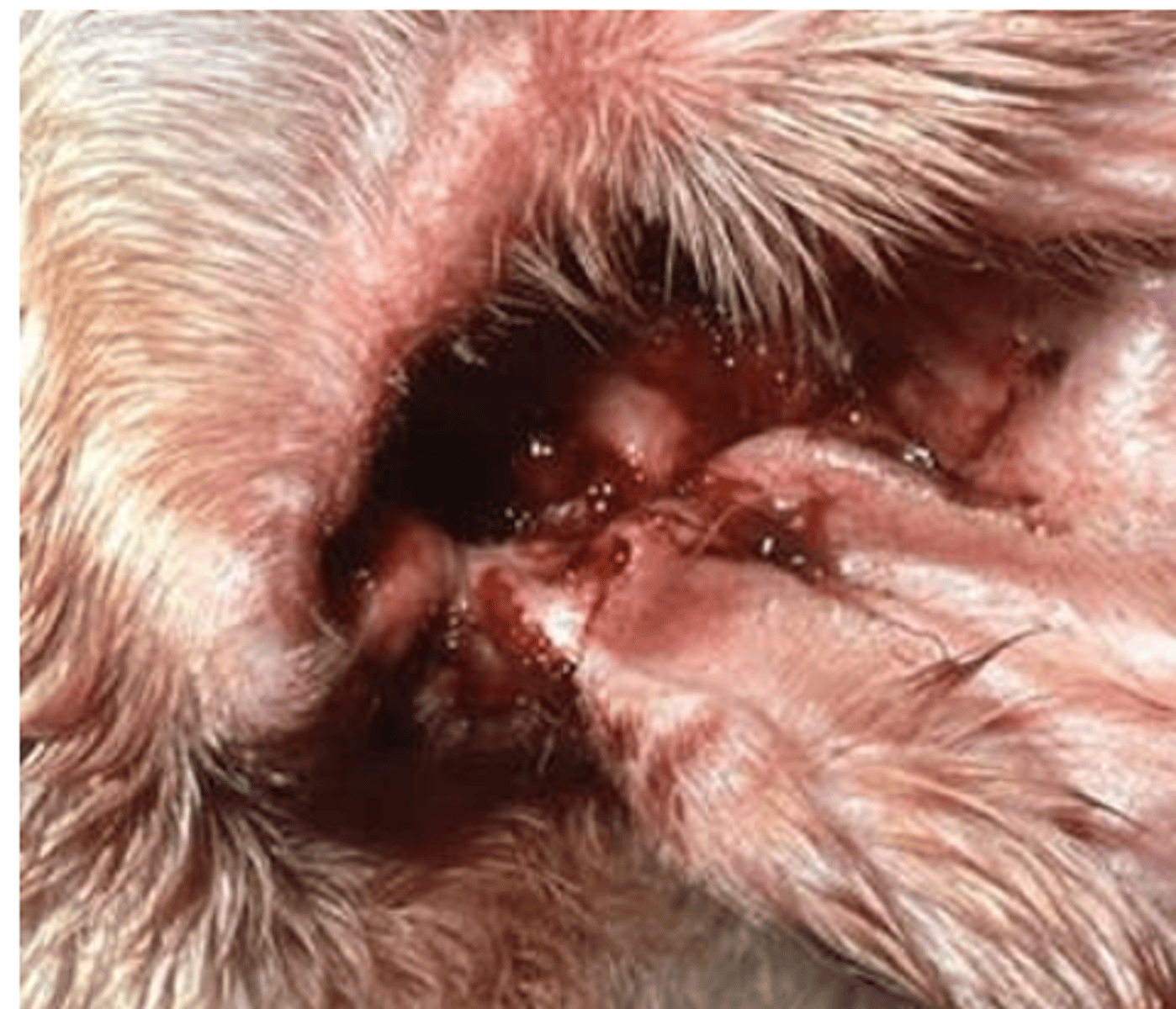 <p>what is this condition called? what yeast species causes it? what sample would we take?</p>