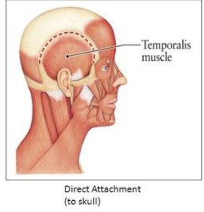 <p><strong>Direct Attachment</strong></p>