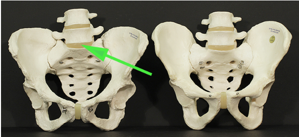 <p>What is the structure indicated by the green arrow?</p>