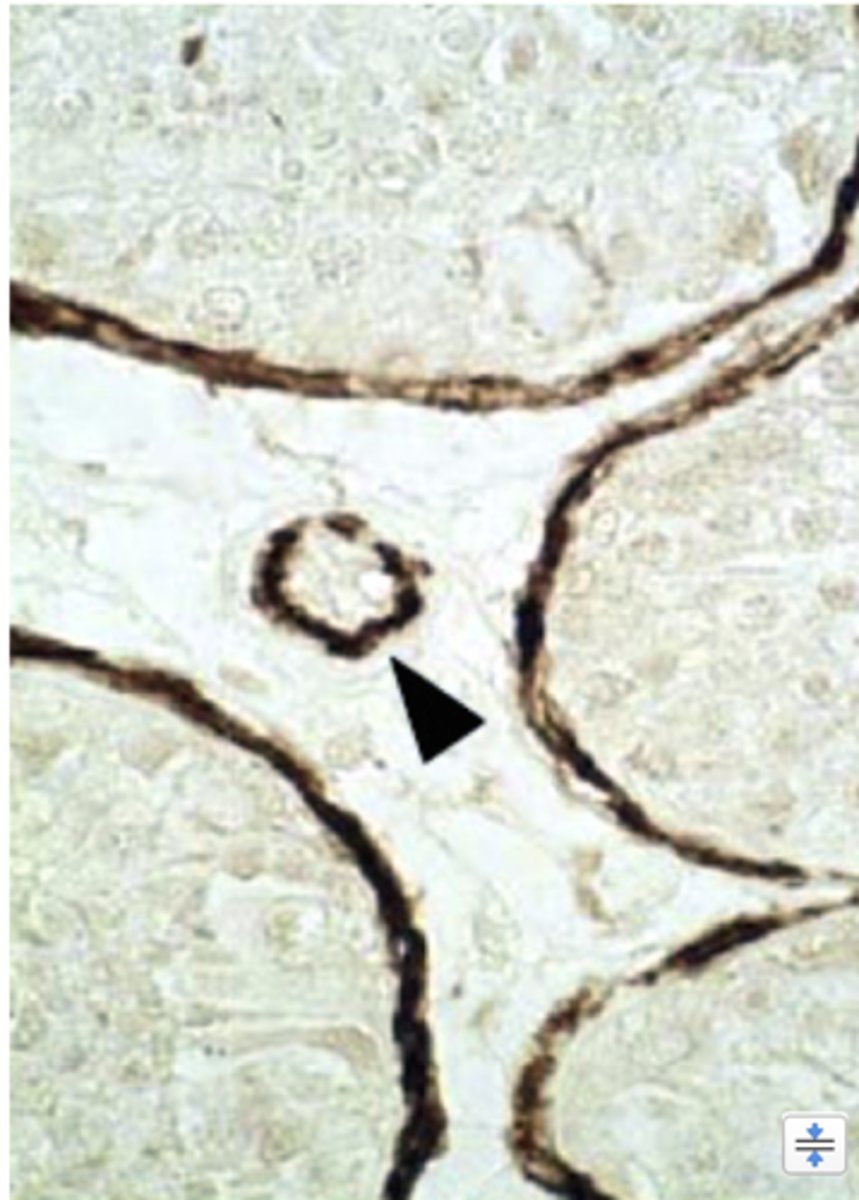 <p>What is the arrow pointing to?</p>