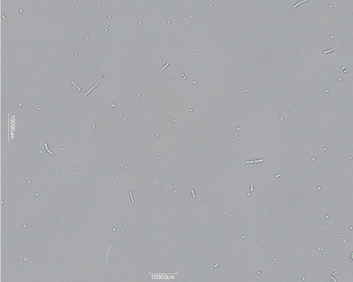 <p>what does the presence of bacteria indicate? what cause a follow up with a urine culture? what bacteria is associated with UTIs?</p>