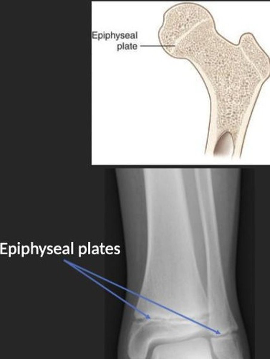 <p>Cartilage allowing longitudinal bone growth.</p>